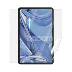 Screenshield DOOGEE T20 LTE flia na cel telo DOO-T20-B