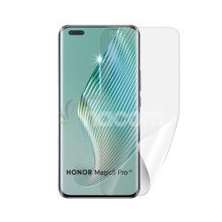Screenshield HUAWEI Honor Magic 5 Pre flie na displej HUA-HONM5PR-D