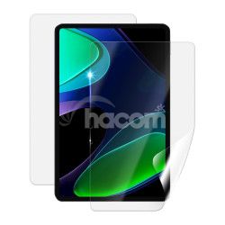 Screenshield XIAOMI Pad 6 flia na cel telo XIA-P6-B